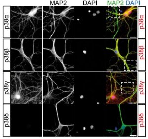 Protena tau no crebro tambm pode ter efeito protetor contra Alzheimer