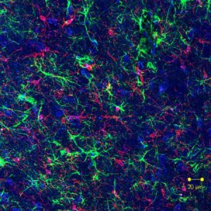 Confirmada conexo entre Parkinson e bactrias intestinais