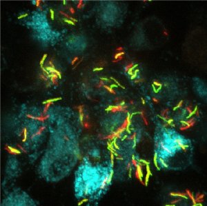 Planta medicinal torna tuberculose mais fcil de tratar