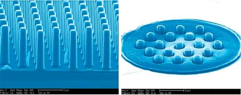 Nanoimplante traz nova esperana de restaurar viso