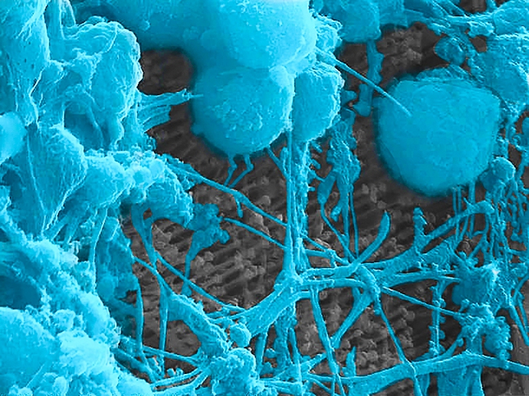 Nanoimplante traz nova esperana de restaurar viso