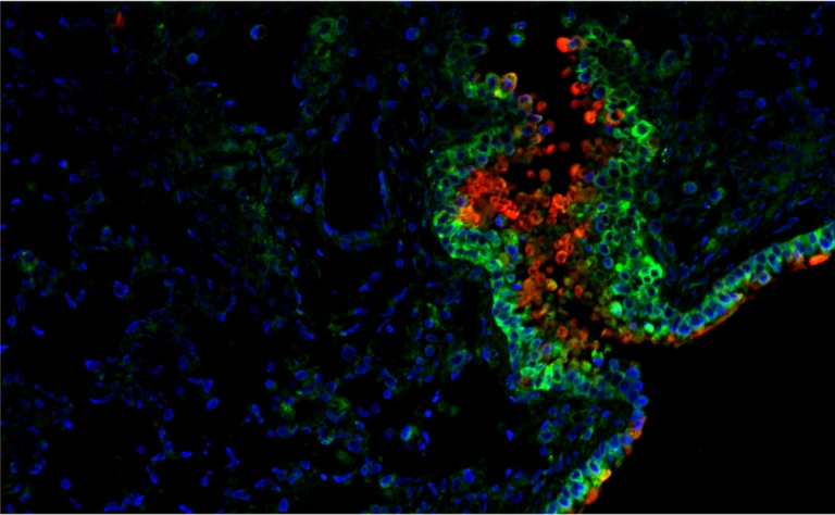 Vitamina D controla microbiota intestinal e reduz risco cardiometablico