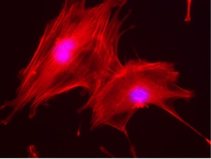 Ma vira biomaterial para regenerao de ossos e cartilagens