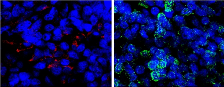 Drogas psicodlicas afetam minicrebros e mostram potencial teraputico