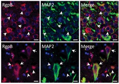 Falha teste de medicamento para preveno do Alzheimer