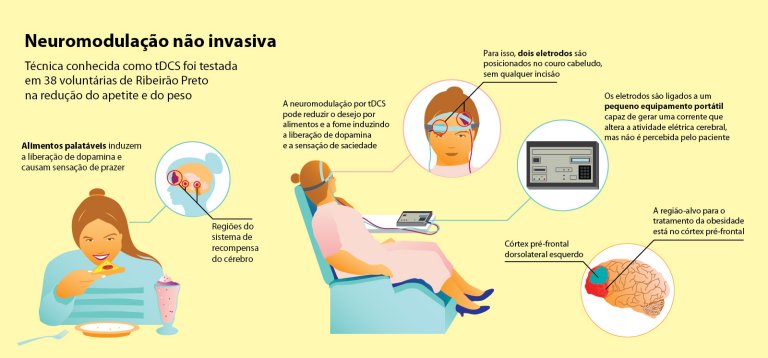 Neuromodulao contra obesidade no funciona para todos os pacientes