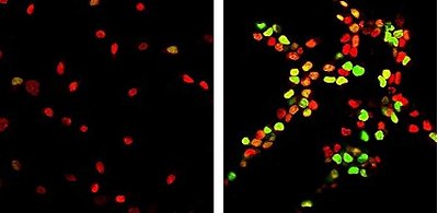 Cientistas revertem envelhecimento de clulas cerebrais