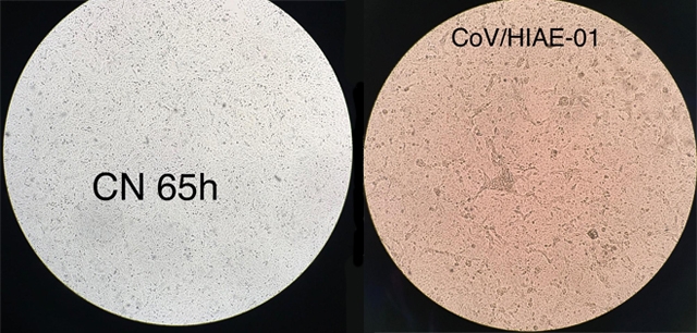 Cientistas da USP replicam novo coronavrus em laboratrio