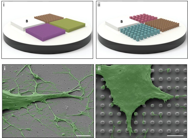 Nanotecnologia aumenta em quatro vezes crescimento sseo aps implante