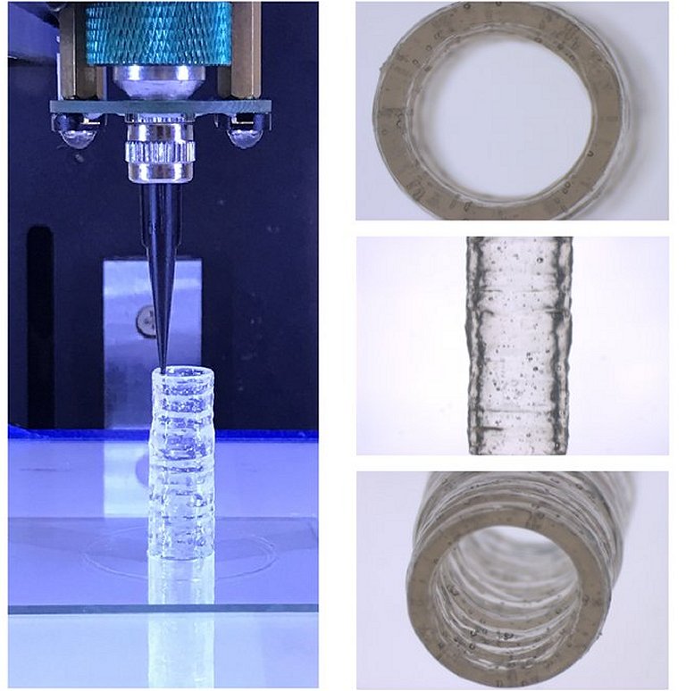 Vasos sanguneos impressos em 3D vo ajudar a compreender doenas vasculares