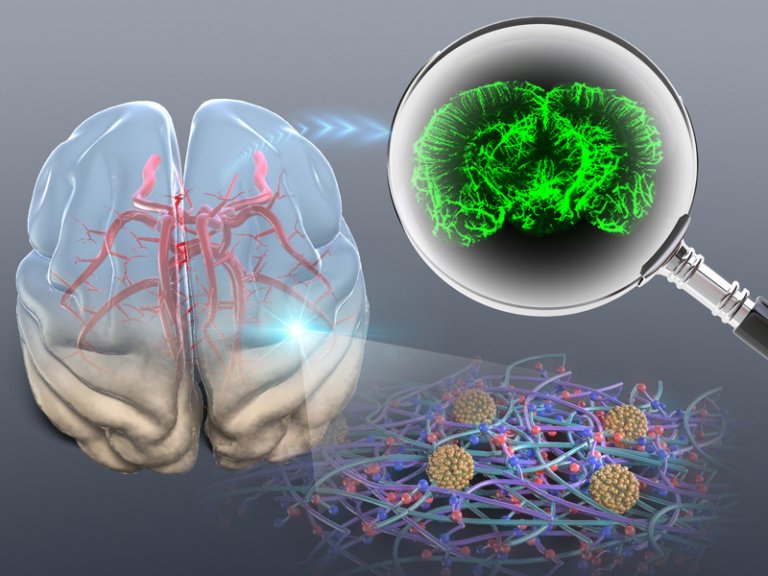 Tcnica deixa tumores transparentes para fazer bipsia 3D