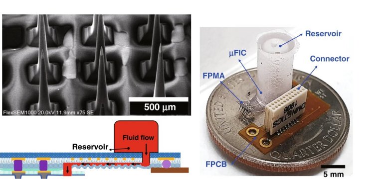 Interface neural multifuncional e flexvel monitora crebro e aplica medicamento