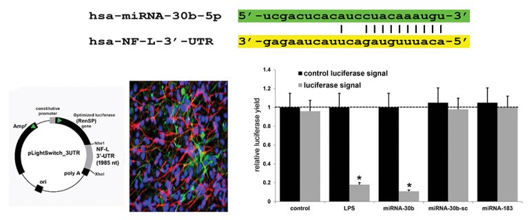 Bactria intestino Alzheimer ingerir fibras