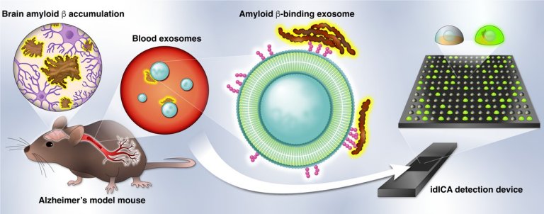 Nova esperana de um exame de sangue para diagnosticar Alzheimer