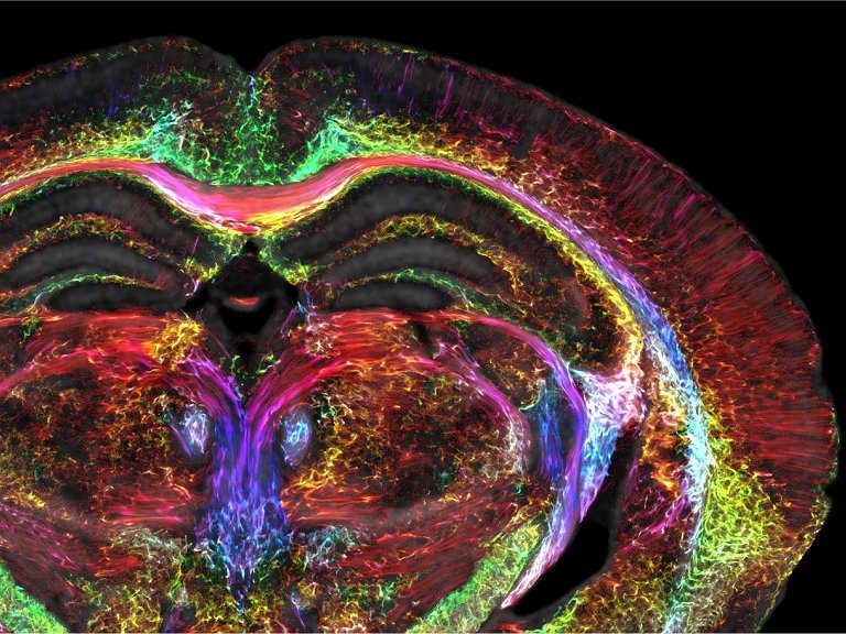 Imagens de ressonncia magntica ficam 64 milhes de vezes mais ntidas