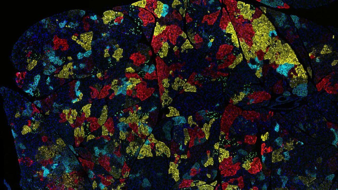 O cncer tem muitas faces? Veja 5 maneiras contraintuitivas que os cientistas esto adotando