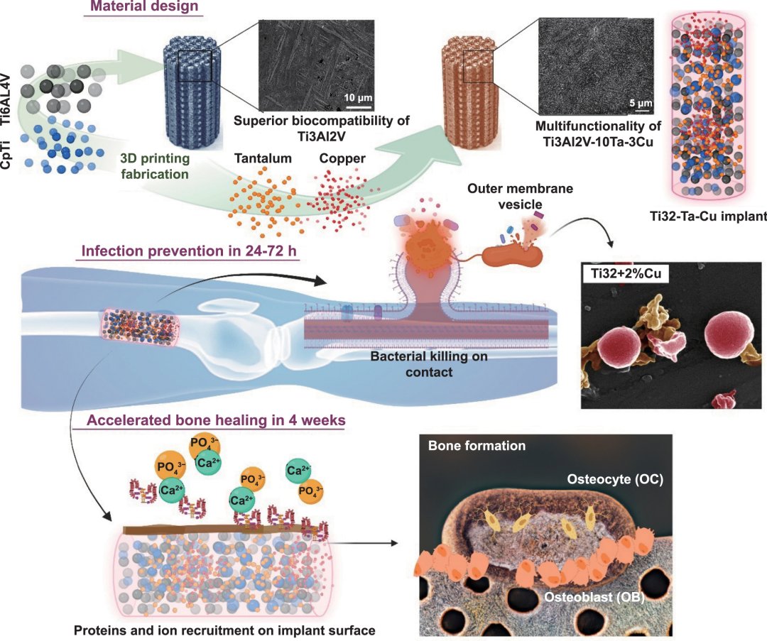 Metais impressos em 3D tornam implantes resistentes a infeces