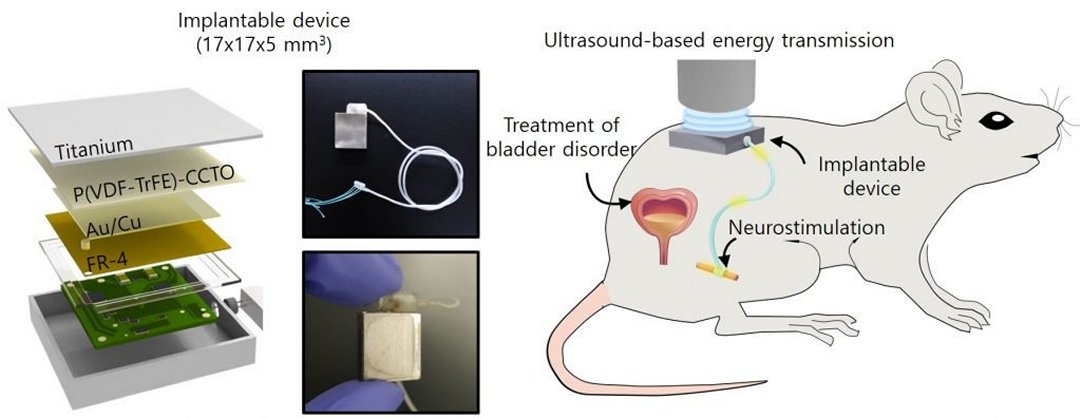 Gerador de eletricidade esttica alimentar nova gerao de implantes mdicos