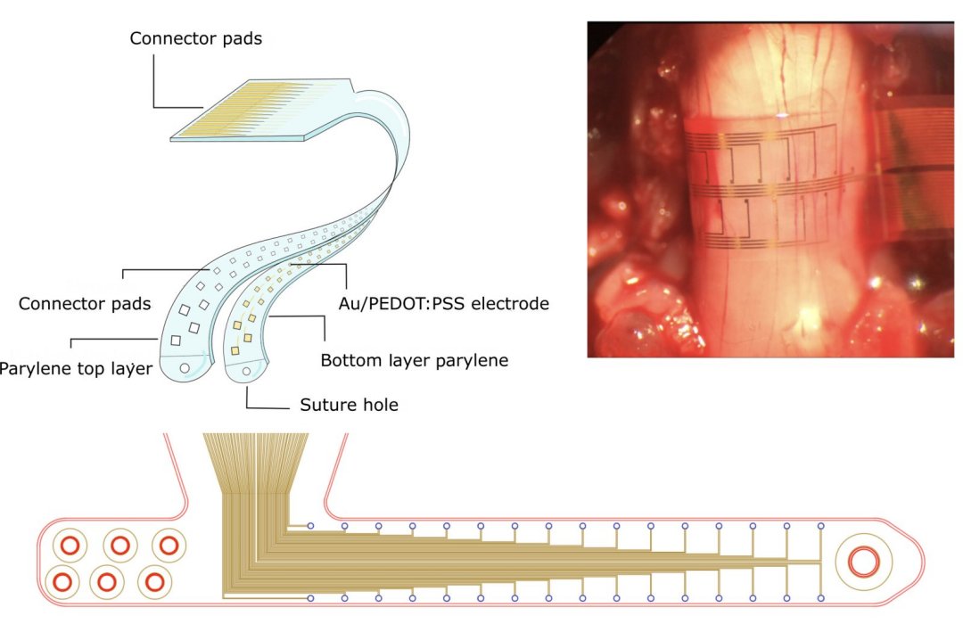 Implante envolvente representa nova abordagem para tratamento da medula espinhal