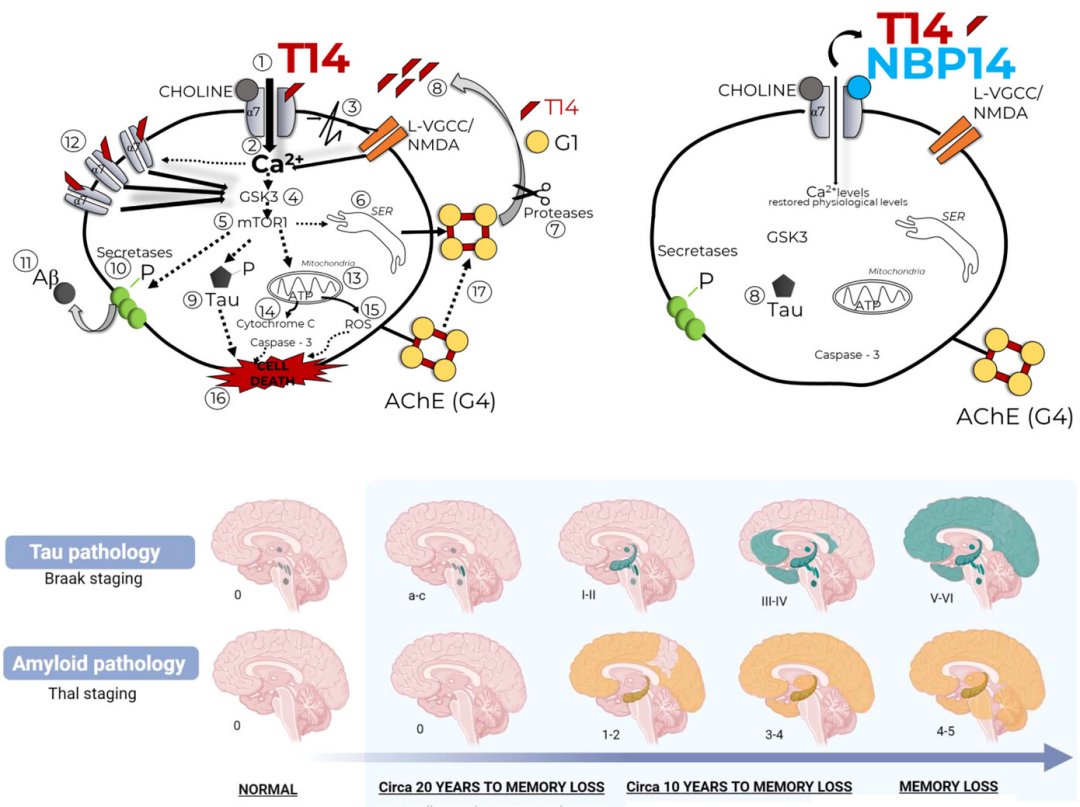 Alzheimer: Cientistas propem uma nova perspectiva sobre a doena