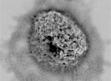 Transmisso da tuberculose no depende apenas da bactria