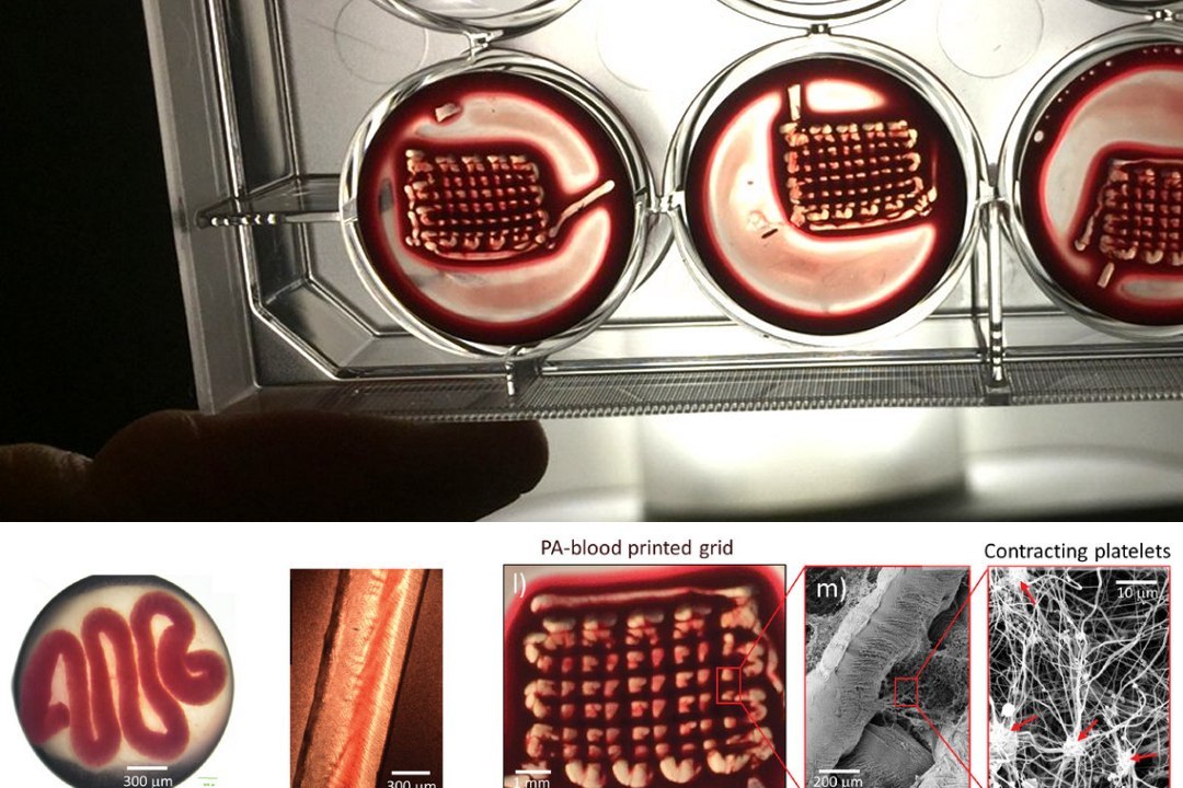 Cientistas transformam sangue em materiais biocooperativos que regeneram tecidos