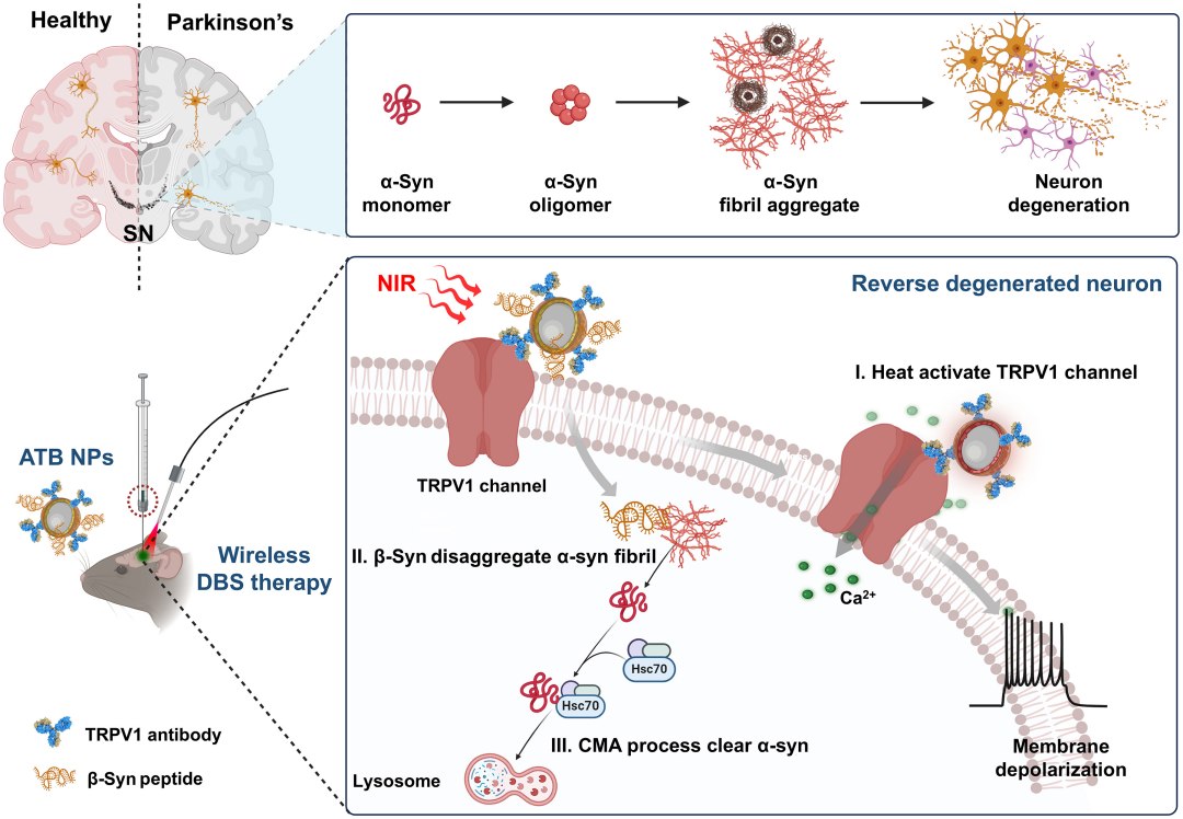 Parkinson retrocede com tratamento de estimulao cerebral com nanopartculas