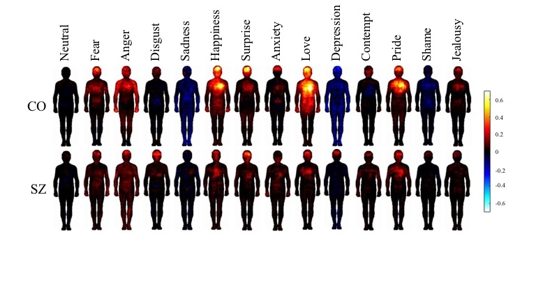 Esquizofrenia muda forma como pessoas experimentam emoes