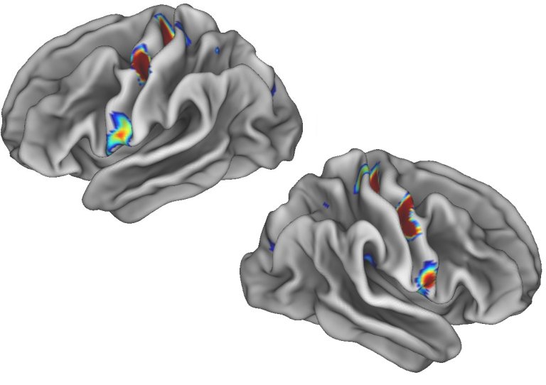 Cientistas dizem ter encontrado conexo mente-corpo - de novo