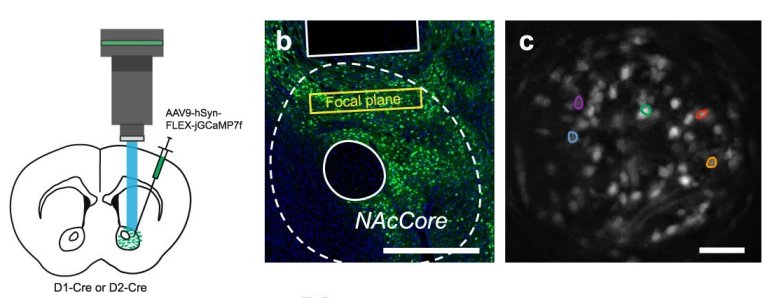 Descoberta via cerebral que nos permite aprender com nossos erros