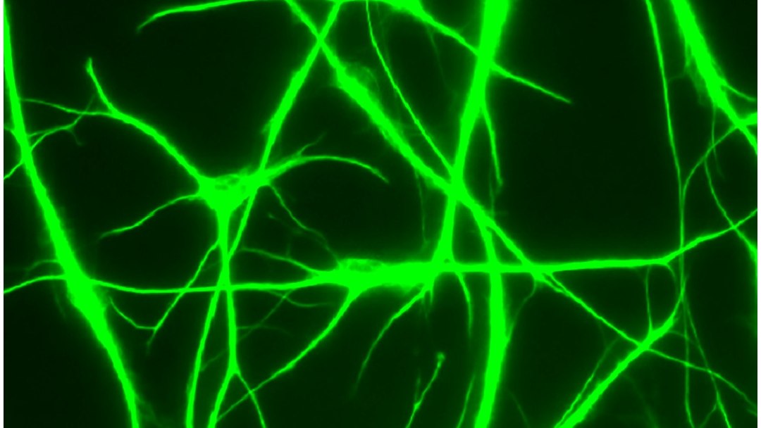 Fundaes da inteligncia humana podem ter sido observados pela primeira vez