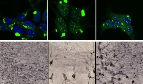 Alzheimer: Forma dos agregados pode importar mais que a protena