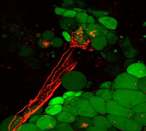 Descoberta rota neuronal para ativar perda de peso