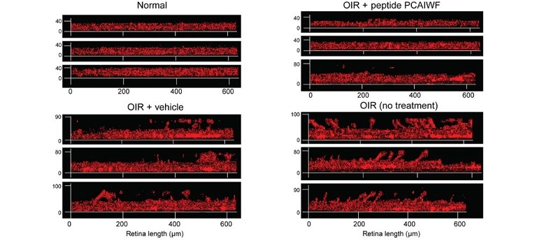 Brasileiros identificam substncia para tratar retinopatia e cncer