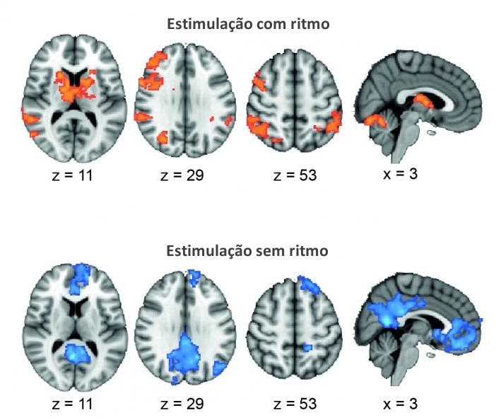 Estimulao eltrica melhora memria sincronizando ondas cerebrais