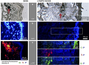 Tatuagens geram nanopartculas que se depositam nos gnglios