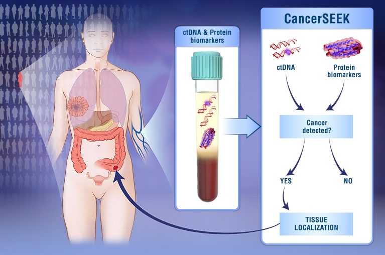 Exame de sangue detecta oito tipos de cncer