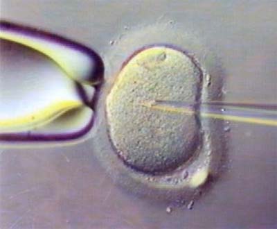 Nova tcnica de fertilizao <i>in vitro</i> no apresenta ganhos