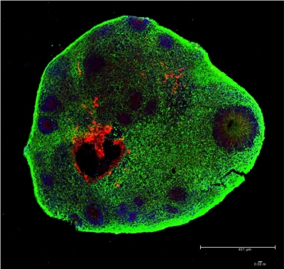 Minicrebros em laboratrio desenvolvem clulas da retina