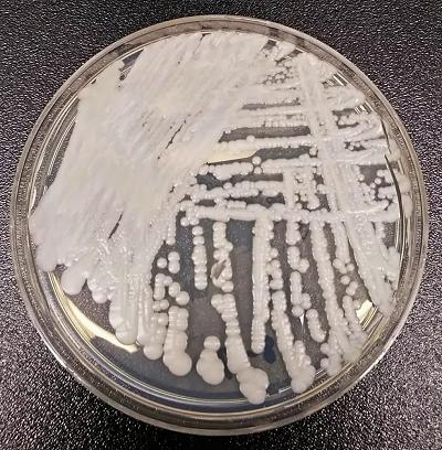 Fungo Candida auris