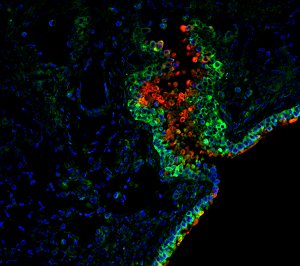 Diferentes teorias sobre microbioma humano levam a diferentes terapias