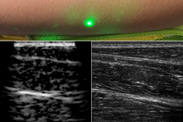 Ultra-som a laser