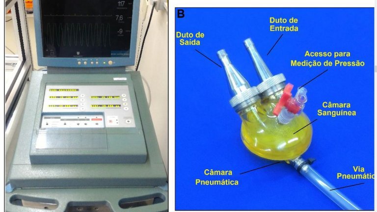 Tecnologias brasileiras para reduzir mortes por doenas cardiovasculares