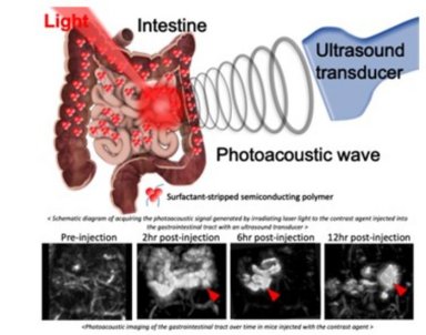 Exame de imagem fotoacstica enxerga cada vez mais fundo no corpo