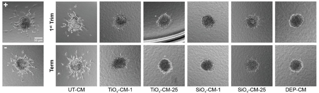 Nanopartculas representam um risco real para bebs no tero