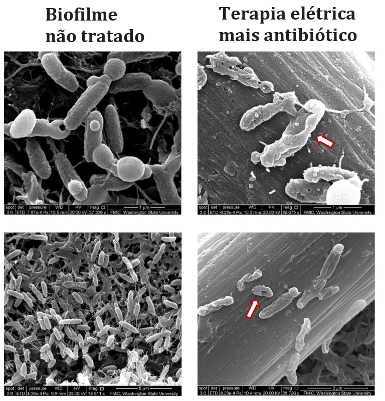 Eletricidade mata bactrias resistentes a antibiticos