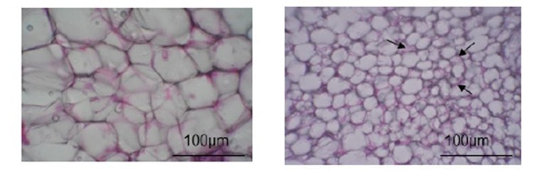 Flavonoides convertem gordura ruim em gordura boa