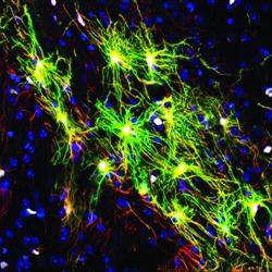 Camundongo recebe transplante de neurnios humanos e fica mais inteligente