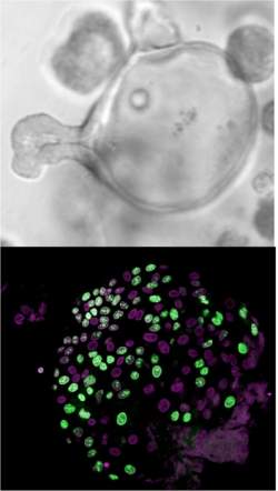 Cientistas cultivam clulas-tronco intestinais em laboratrio