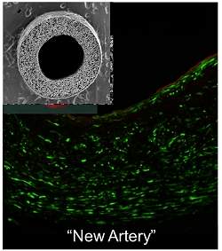 Enxerto arterial biodegradvel muda filosofia de cirurgias cardacas